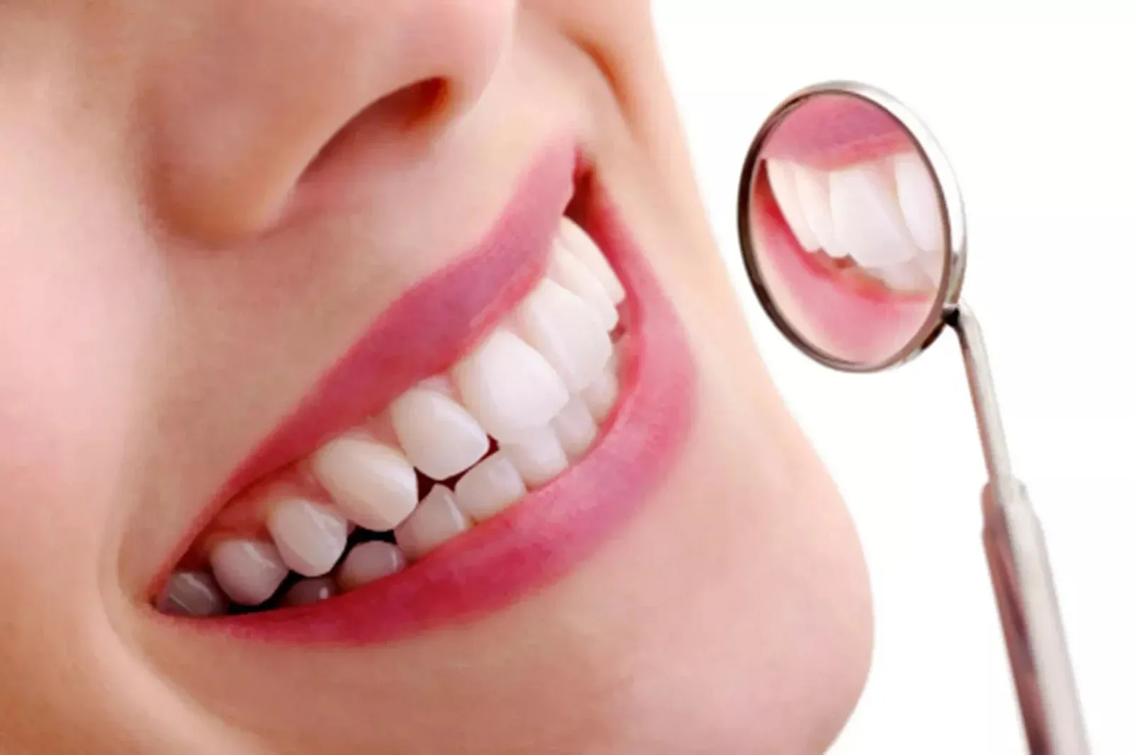 GlorySmile Teeth Whitening kit