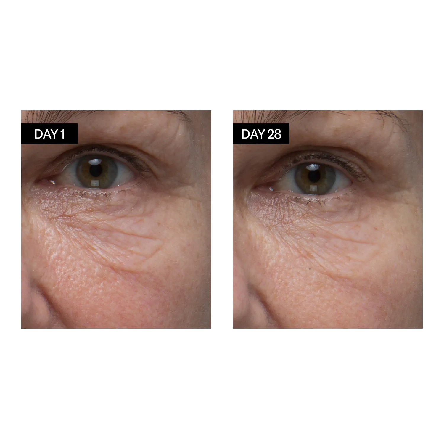 Renewing Serum  • Retinol   Hyaluronic Acid
