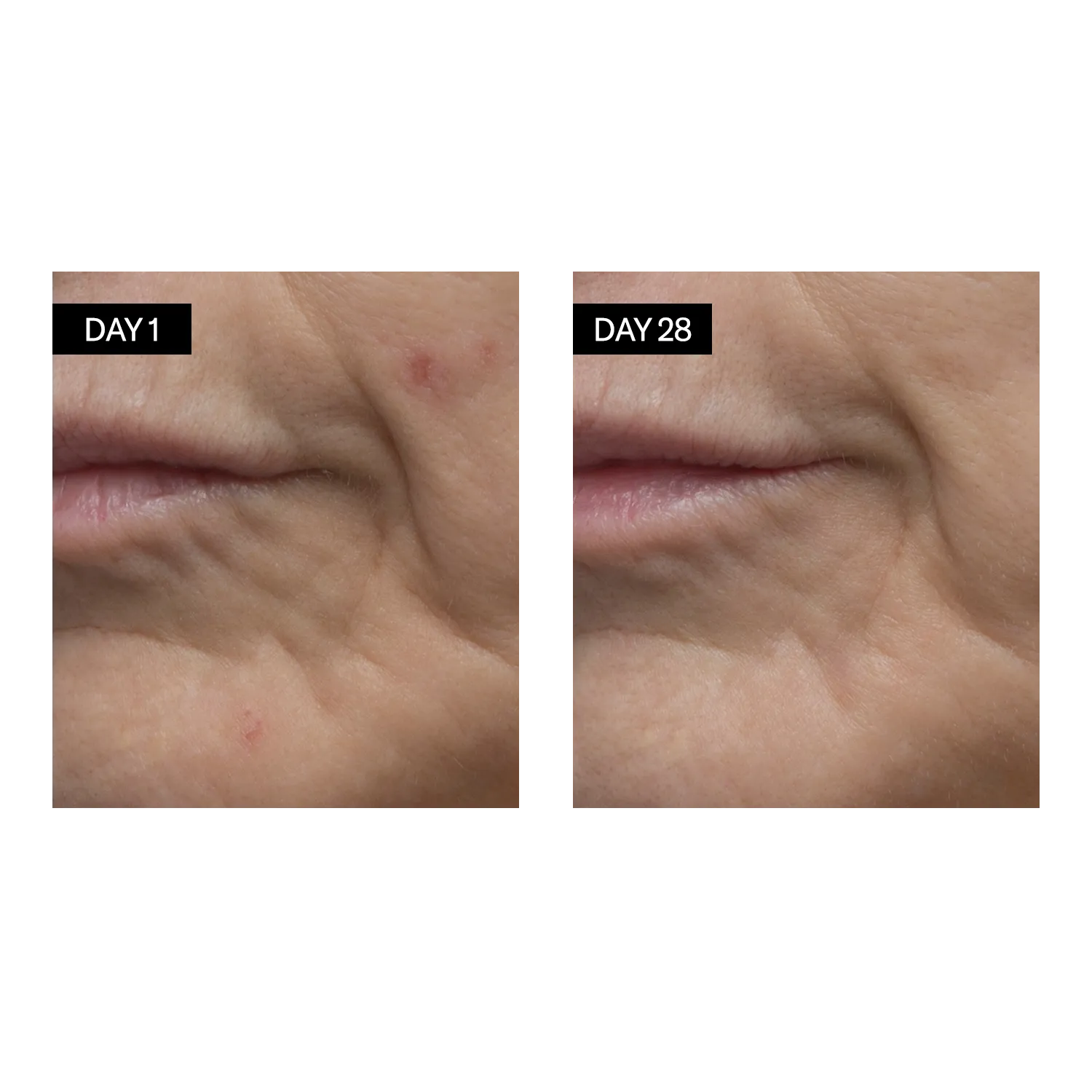 Renewing Serum  • Retinol   Hyaluronic Acid
