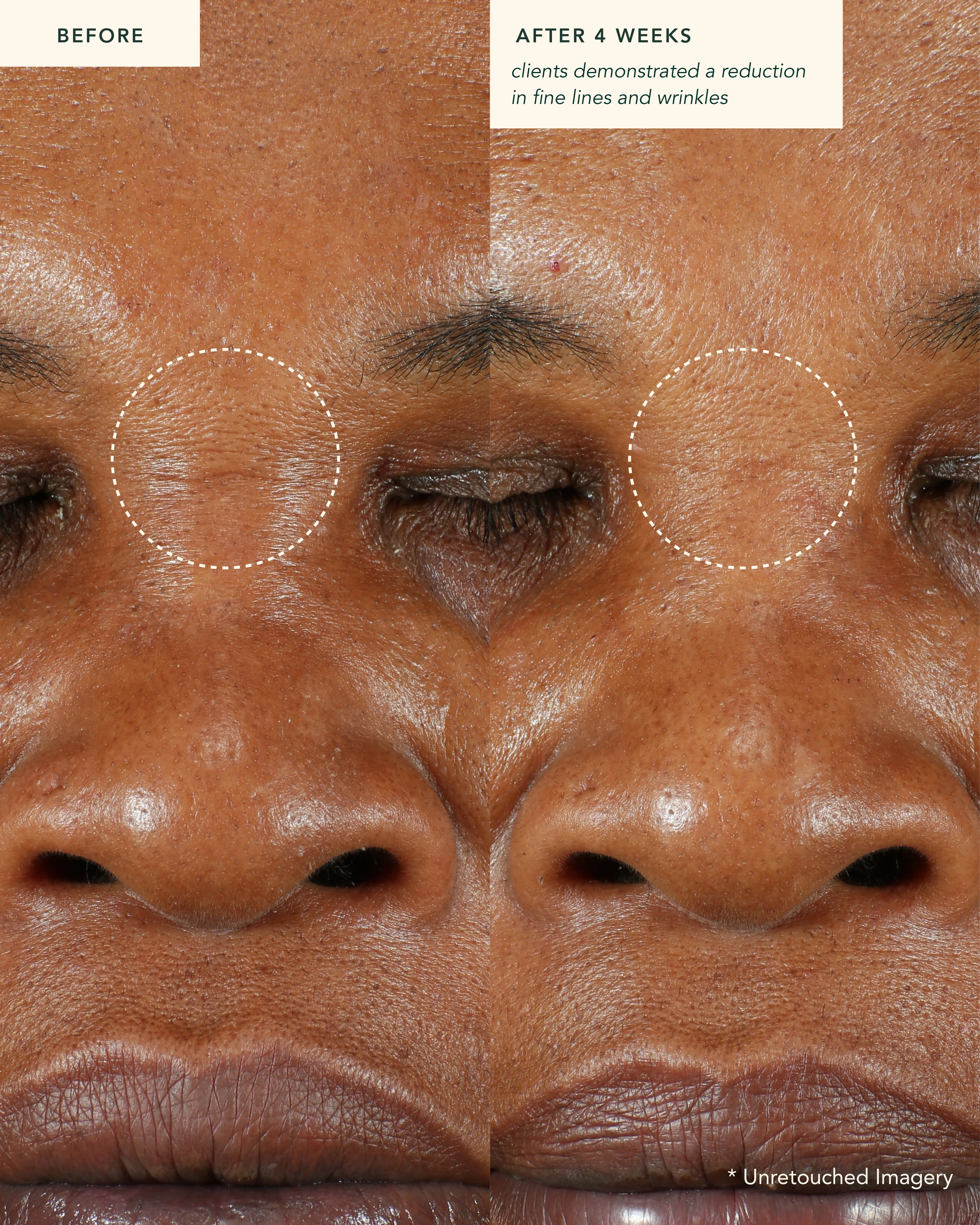 Restoring Moonseed Treatment (Mini)