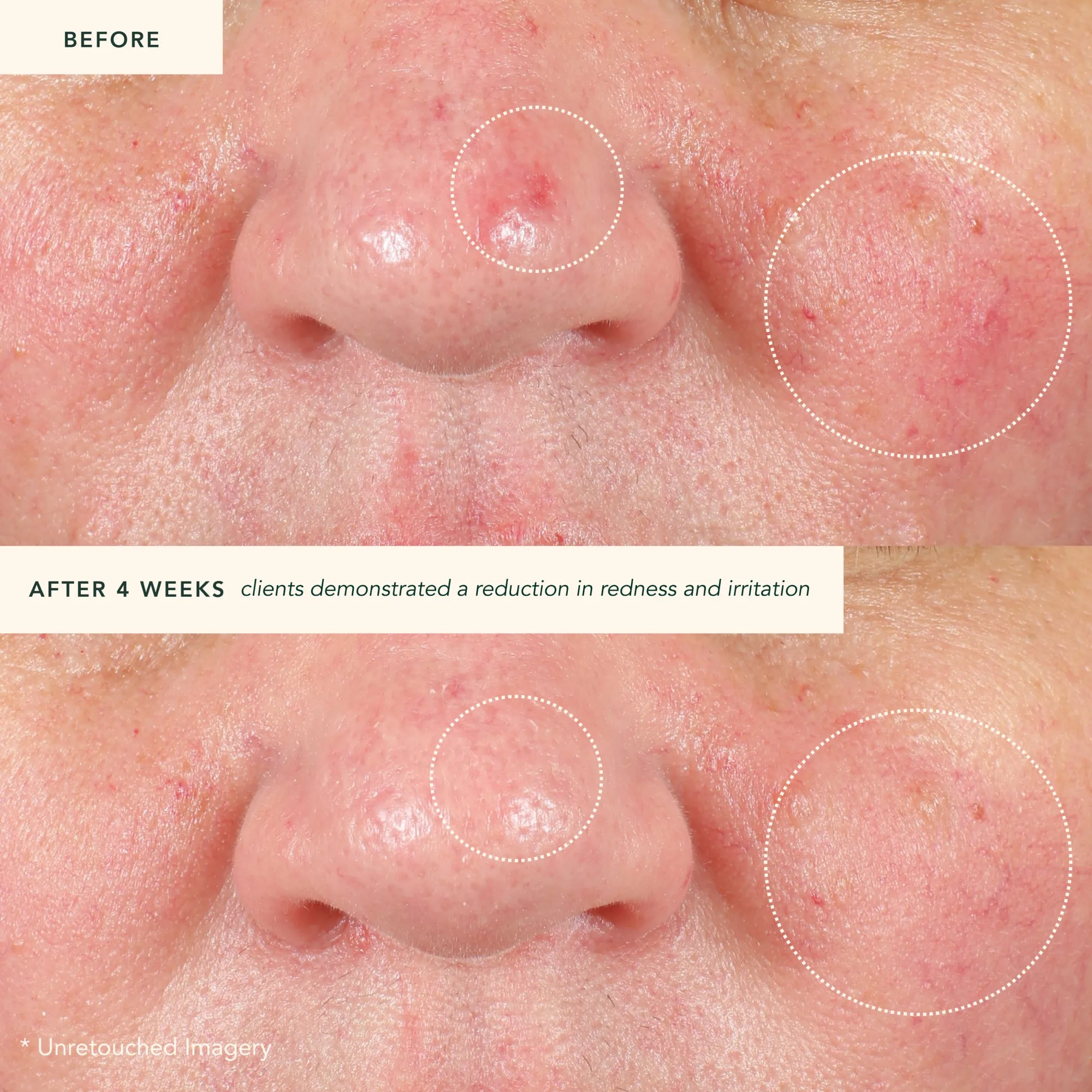 Restoring Moonseed Treatment (Mini)