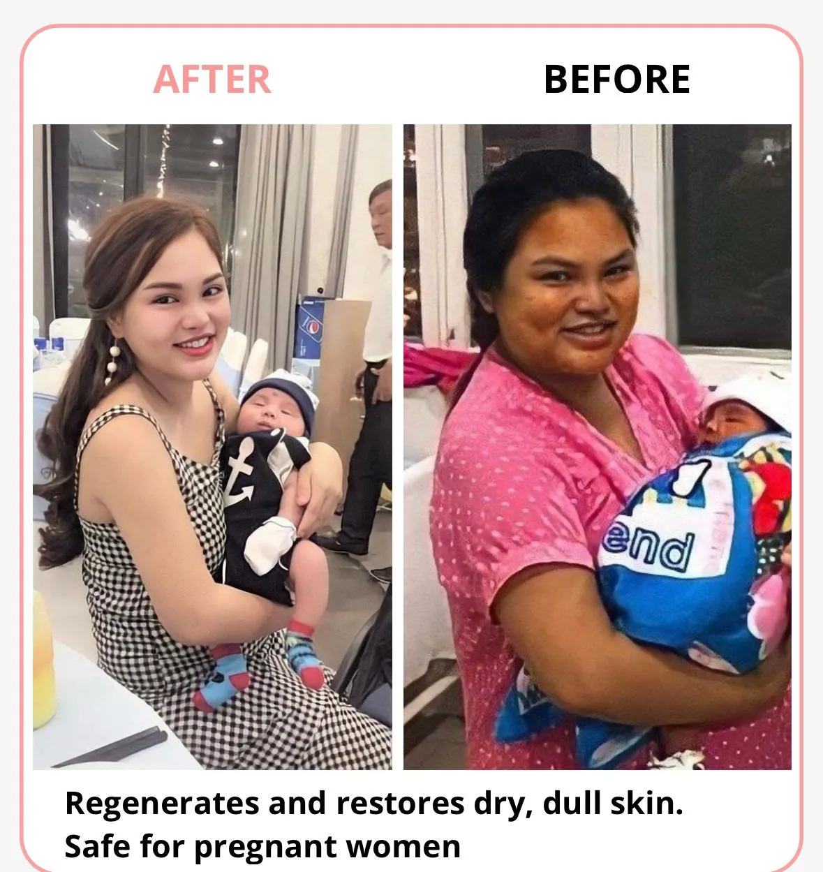 SKIN WHITENING (50% Off)