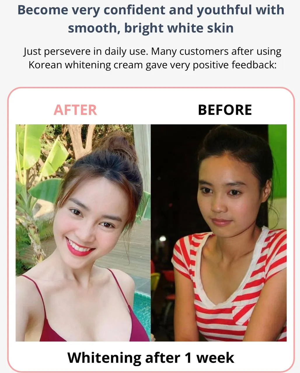 SKIN WHITENING (50% Off)